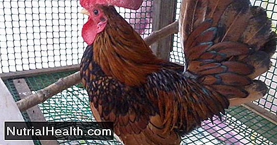 Diet: Apakah Ayam Membungkus Sehat? - 20242024.MarMar.ThuThu