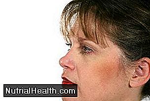 La perdita di collagene dovuta all'invecchiamento causa effetti visibili.